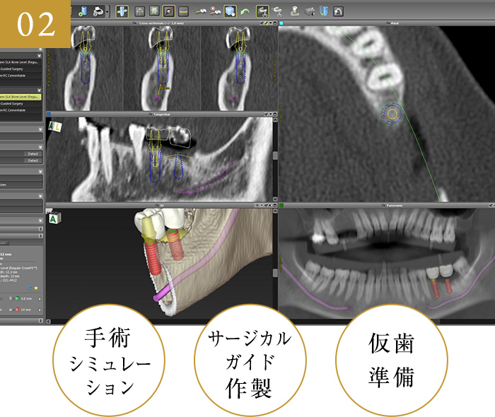 手術前準備