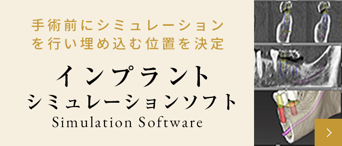 インプラントシミュレーションソフト