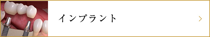 インプラント