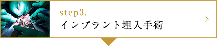 step3.インプラント埋入手術