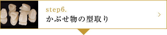 step6.かぶせ物の型取り