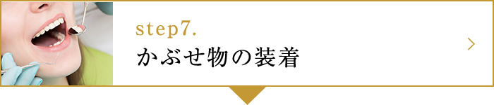 step7.かぶせ物の装着