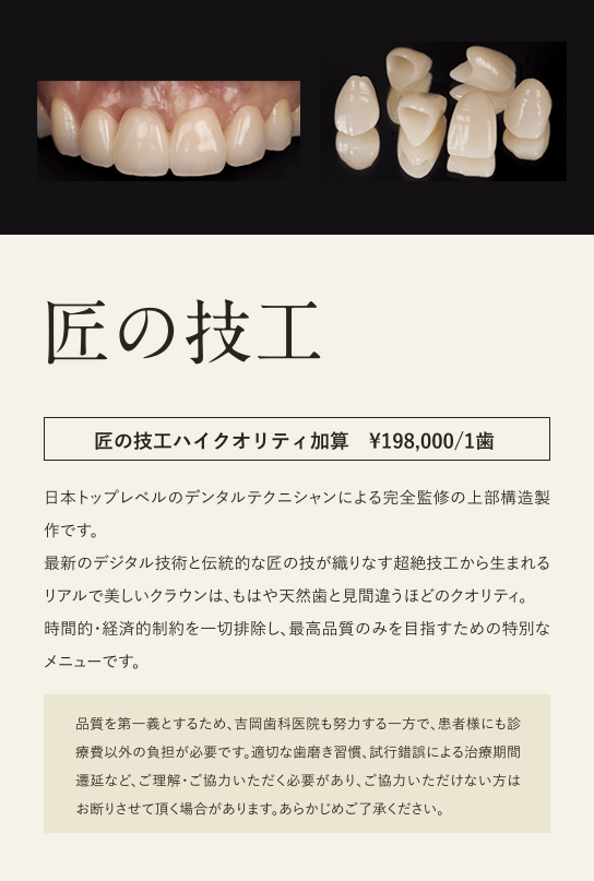 匠の技工