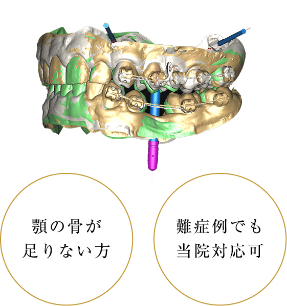 骨造成治療