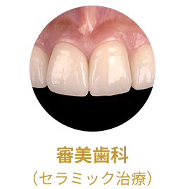 審美歯科(セラミック治療)