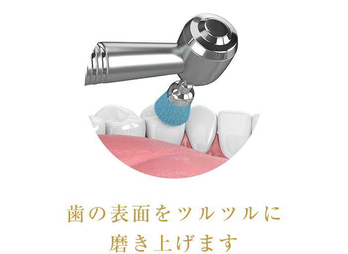 PMTC(プロのクリーニング)