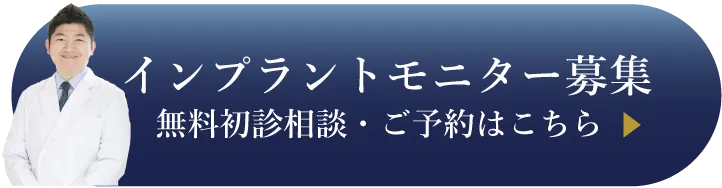 インプラントモニター募集。無料初診相談点ご予約はこちらをクリック