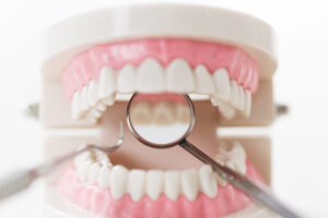 gum_disease_feature_01